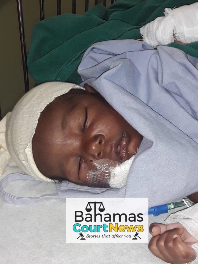 Baby injured as mother is attacked